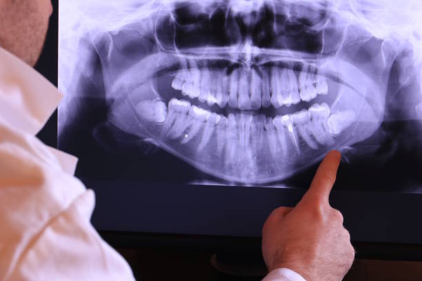 Best Emergency Gum Pain Relief  in Elgin, TX