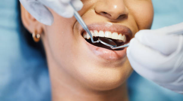 Best Dentist for Tooth Abscess  in Elgin, TX